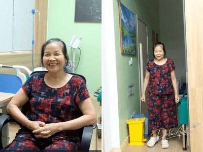 Phục hồi vận động tốt sau phẫu thuật thay khớp háng với đường mổ SuperPath kết hợp keo dán sinh học
